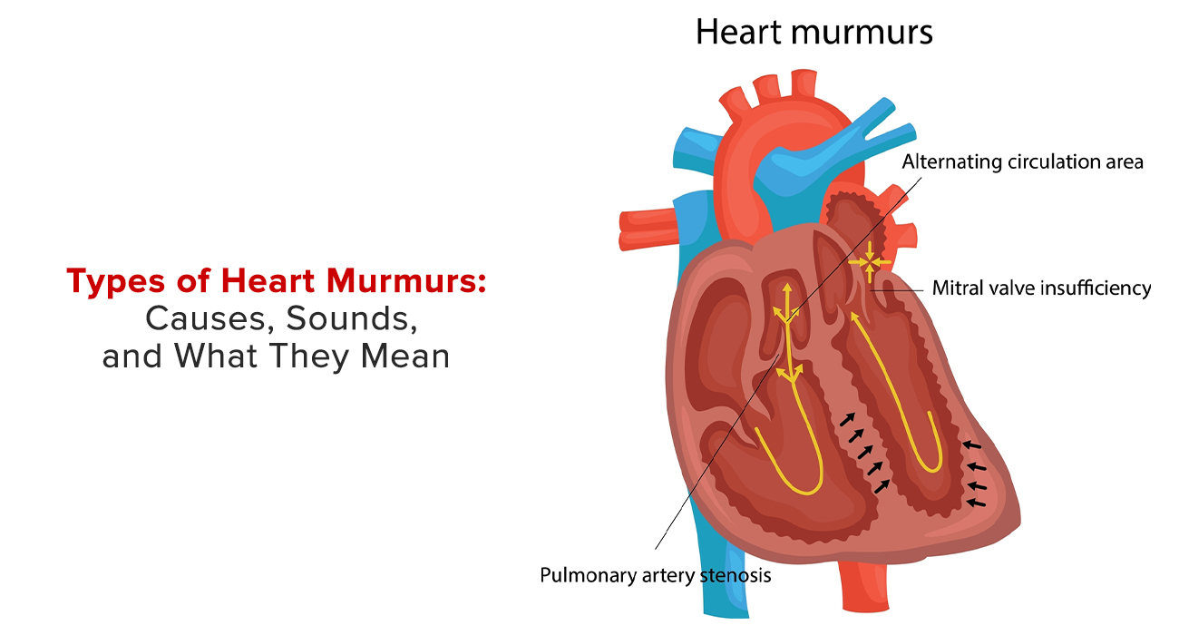 Types Of Heart Murmurs: Causes, Sounds, And What They Mean